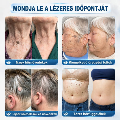 𝑯𝒊𝒗𝒂𝒕𝒂𝒍𝒐𝒔 𝒎á𝒓𝒌𝒂𝒃𝒐𝒍𝒕✅ | 𝑷𝒊𝒄𝒅𝒐® 7 𝒏𝒂𝒑𝒐𝒔 𝒃ő𝒓𝒌𝒊𝒏ö𝒗é𝒔- é𝒔 𝒇𝒐𝒍𝒕𝒆𝒍𝒕á𝒗𝒐𝒍í𝒕ó 𝒕𝒐𝒍𝒍 👩‍⚕️(𝒇á𝒋𝒅𝒂𝒍𝒐𝒎𝒎𝒆𝒏𝒕𝒆𝒔, 𝒉𝒆𝒈 𝒏é𝒍𝒌ü𝒍𝒊, 𝒑𝒓𝒆𝒄í𝒛𝒊ó𝒔 𝒈𝒐𝒍𝒚ó𝒔 𝒂𝒑𝒑𝒍𝒊𝒌á𝒕𝒐𝒓) -🔥