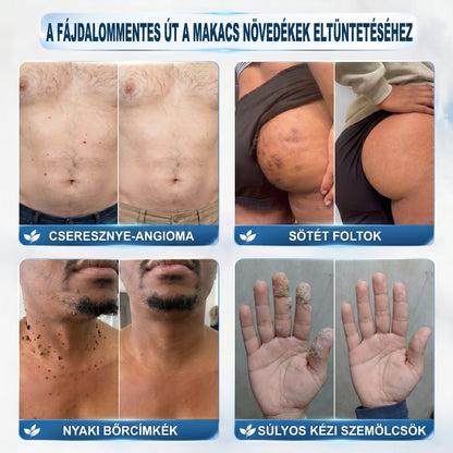 𝑯𝒊𝒗𝒂𝒕𝒂𝒍𝒐𝒔 𝒎á𝒓𝒌𝒂𝒃𝒐𝒍𝒕✅ | 𝑷𝒊𝒄𝒅𝒐® 7 𝒏𝒂𝒑𝒐𝒔 𝒃ő𝒓𝒌𝒊𝒏ö𝒗é𝒔- é𝒔 𝒇𝒐𝒍𝒕𝒆𝒍𝒕á𝒗𝒐𝒍í𝒕ó 𝒕𝒐𝒍𝒍 👩‍⚕️(𝒇á𝒋𝒅𝒂𝒍𝒐𝒎𝒎𝒆𝒏𝒕𝒆𝒔, 𝒉𝒆𝒈 𝒏é𝒍𝒌ü𝒍𝒊, 𝒑𝒓𝒆𝒄í𝒛𝒊ó𝒔 𝒈𝒐𝒍𝒚ó𝒔 𝒂𝒑𝒑𝒍𝒊𝒌á𝒕𝒐𝒓) -🔥