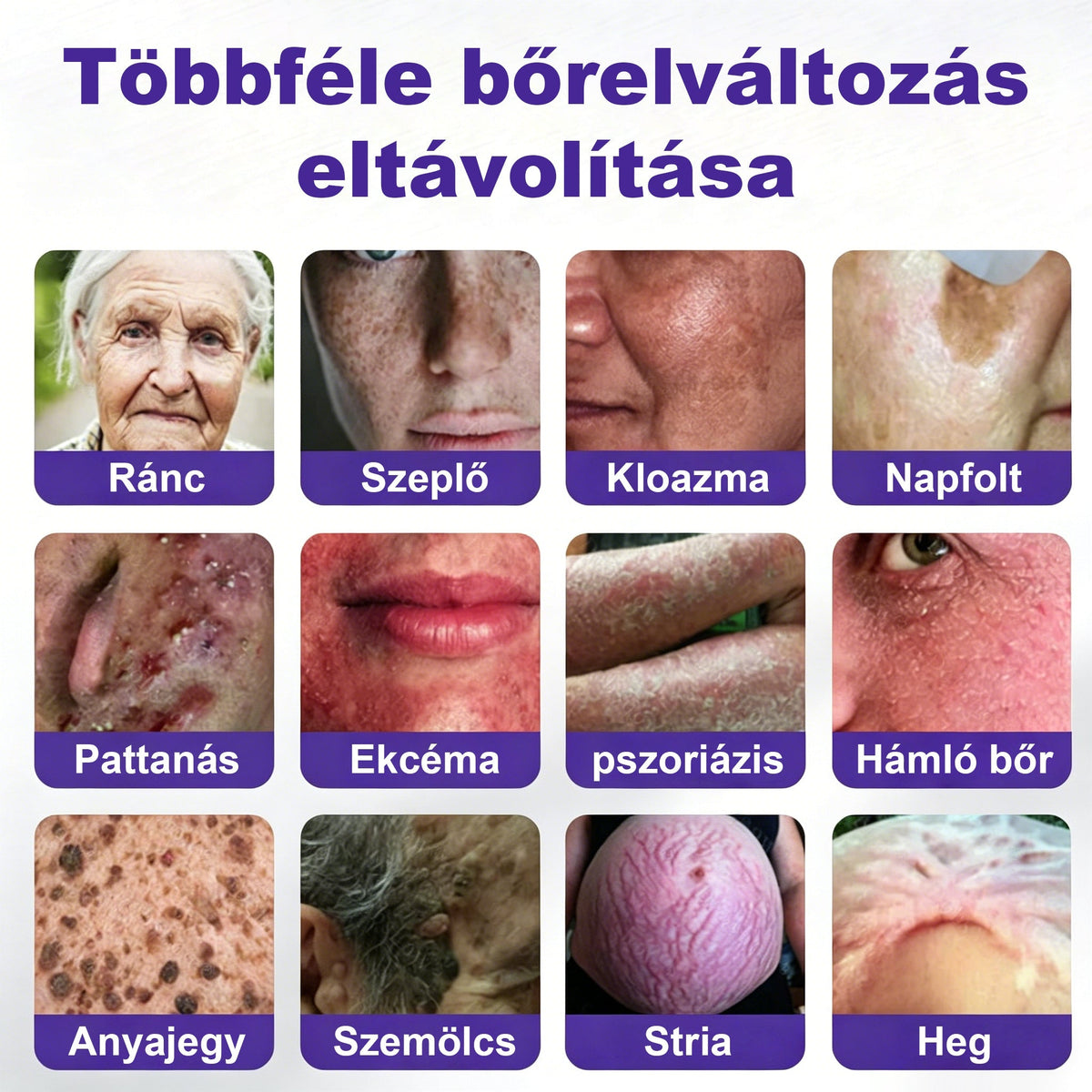 CleraNaure® mikrotűs szemölcs- és anyajegyeltávolító tapasz-🔥
