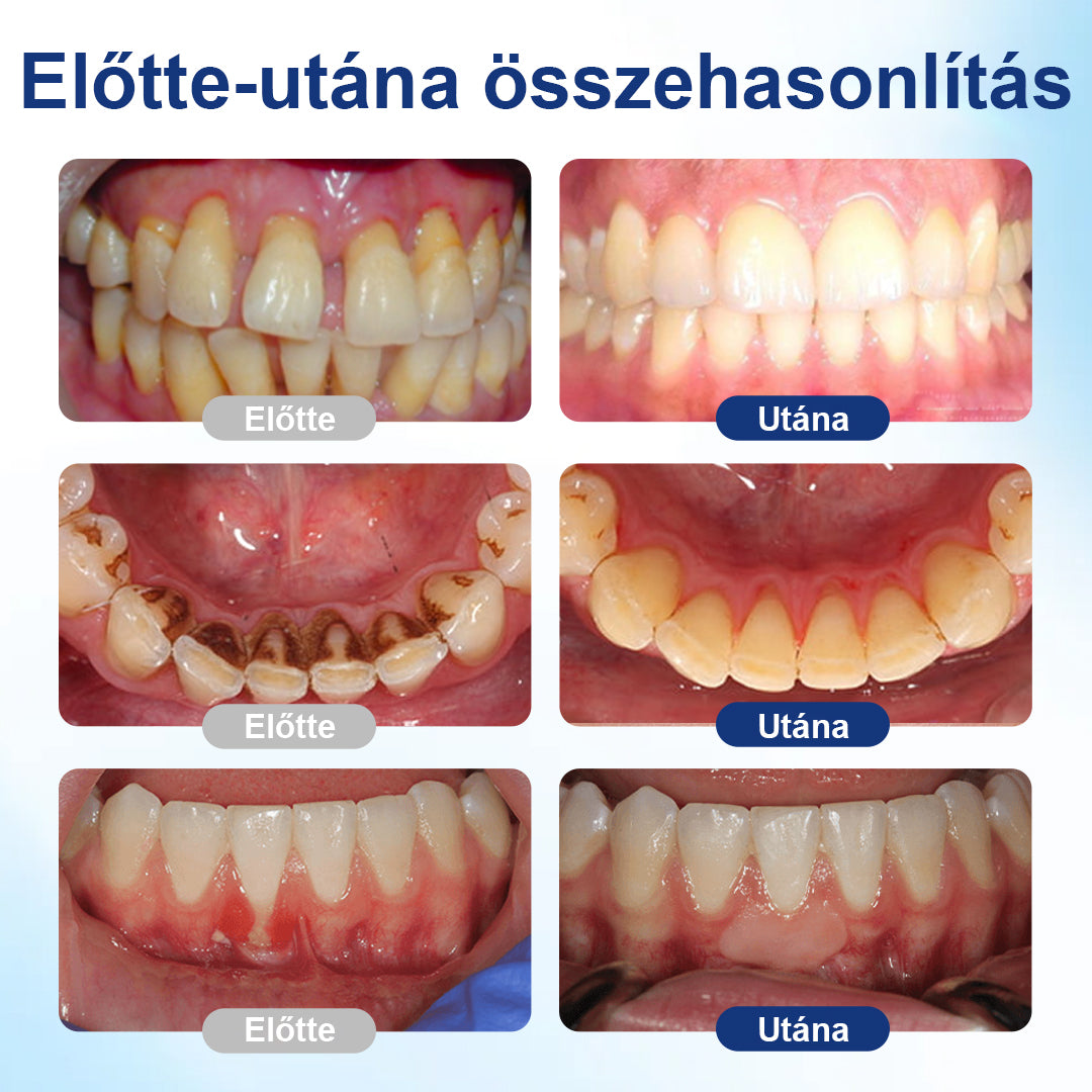🐝 Laleia® BeeTakt szájápoló oldat – friss, kellemes szájérzet a mindennapokra, most különleges akciós áron! Rendeld meg még ma, amíg a készlet tart! 🛒✨