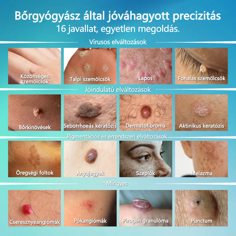Timilk® SpotlessPro Fejlett Bőrápoló Toll-📦