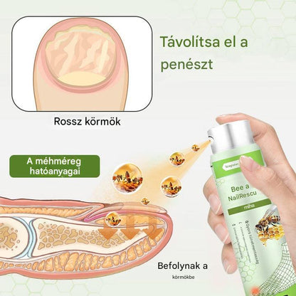 🔥🐝Korlátozott ideig 50%-os kedvezmény | Foulme® NailRescue Méhméreg Spray🐝