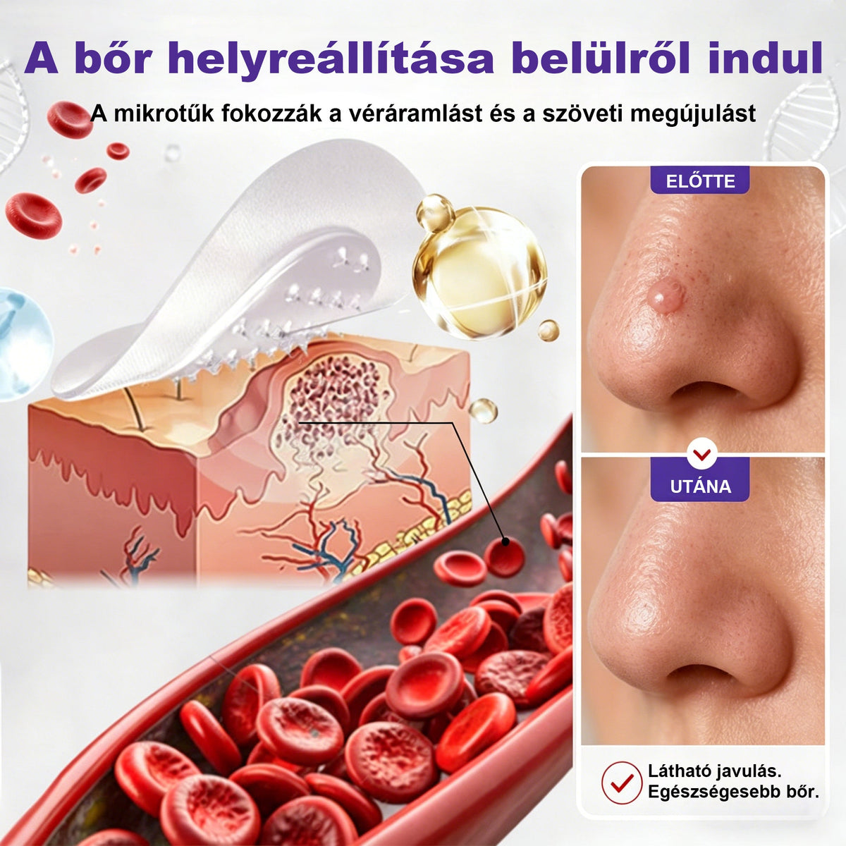 CleraNaure® mikrotűs szemölcs- és anyajegyeltávolító tapasz-🔥