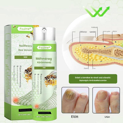 🔥🐝Korlátozott ideig 50%-os kedvezmény | Foulme® NailRescue Méhméreg Spray🐝