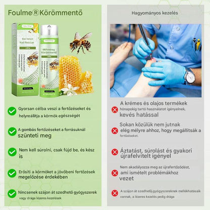 🔥🐝Korlátozott ideig 50%-os kedvezmény | Foulme® NailRescue Méhméreg Spray🐝