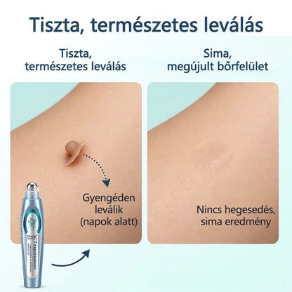 Timilk® SpotlessPro Fejlett Bőrápoló Toll-🔥