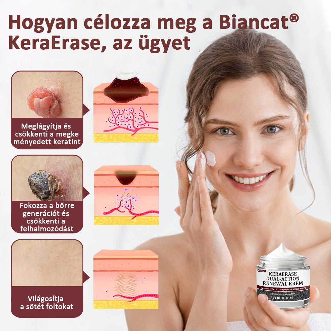 Biancat®KeraErase Dual-Action Renewal Cream