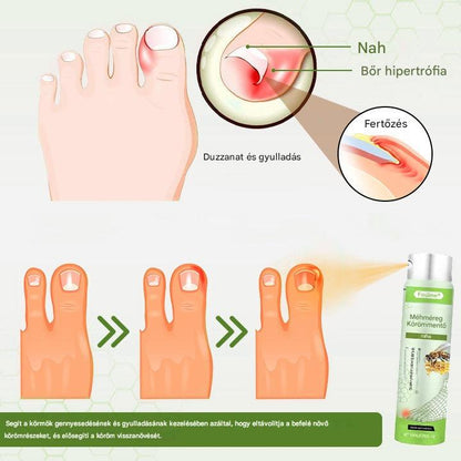 🔥🐝Korlátozott ideig 50%-os kedvezmény | Foulme® NailRescue Méhméreg Spray🐝